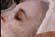 Paraffin Treatments: Face and D�collet�