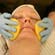 Advanced Chemical Peels: Vol. 1, Alpha Hydroxy Peels