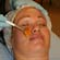 Advanced Chemical Peels: Vol. 1, Alpha Hydroxy Peels
