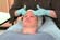 Advanced Chemical Peels: Vol. 1, Alpha Hydroxy Peels