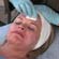 Advanced Chemical Peels: Vol. 2, Beta Hydroxy Peels