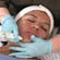 Advanced Chemical Peels: Vol. 3, Microdermabrasion Peels