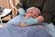 Advanced Chemical Peels: Vol. 3, Microdermabrasion Peels