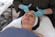 Advanced Chemical Peels: Vol. 4, Medical Grade Peels