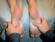 Comprehensive Reflexology & Massage Set