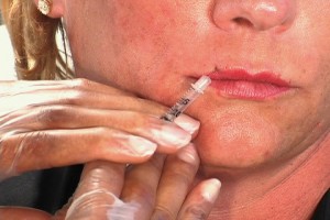 Botox Injection Techniques - Learn How to Inject Botox