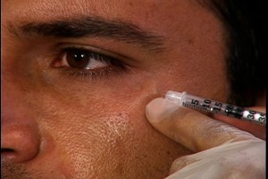 Botox Injection Training with experienced Cosmetic Surgeon - Learn how to inject botox with online videos - DVDs