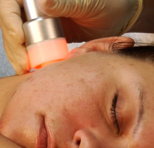 LED Microdermabrasion Training DVD Video Paramedical Aesthetician Training Tina Zillmann