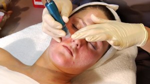 Anti-Aging Treatments for Oily Skin Aesthetician Training Video | DVD with Tina Zillmann