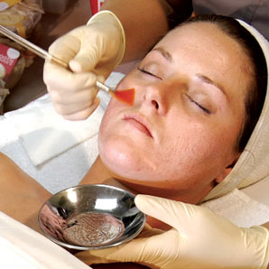 aesthetician-training-acne-oily-skin-chemical-peel-video-dvd