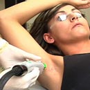 Training with laser hair removal